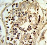 ABHD12 Antibody (aa40-66)