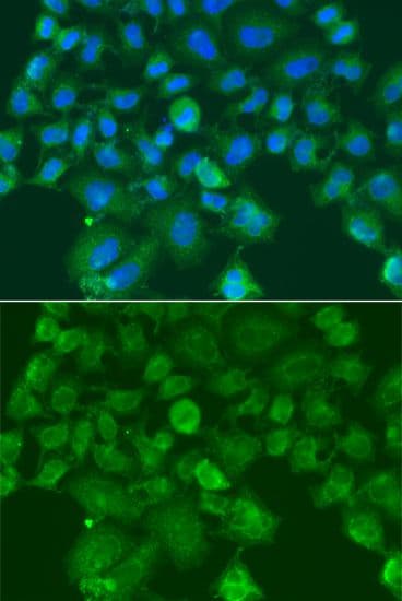 CST1 / Cystatin SN Antibody
