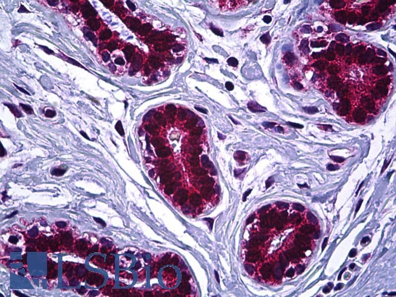 IHC-plus™ Polyclonal Rabbit anti-Human IGF2R / CD222 Antibody (aa2441-2490, IHC, IF)