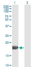 PathPlus™ FGF1 / Acidic FGF Antibody (clone 2E12)
