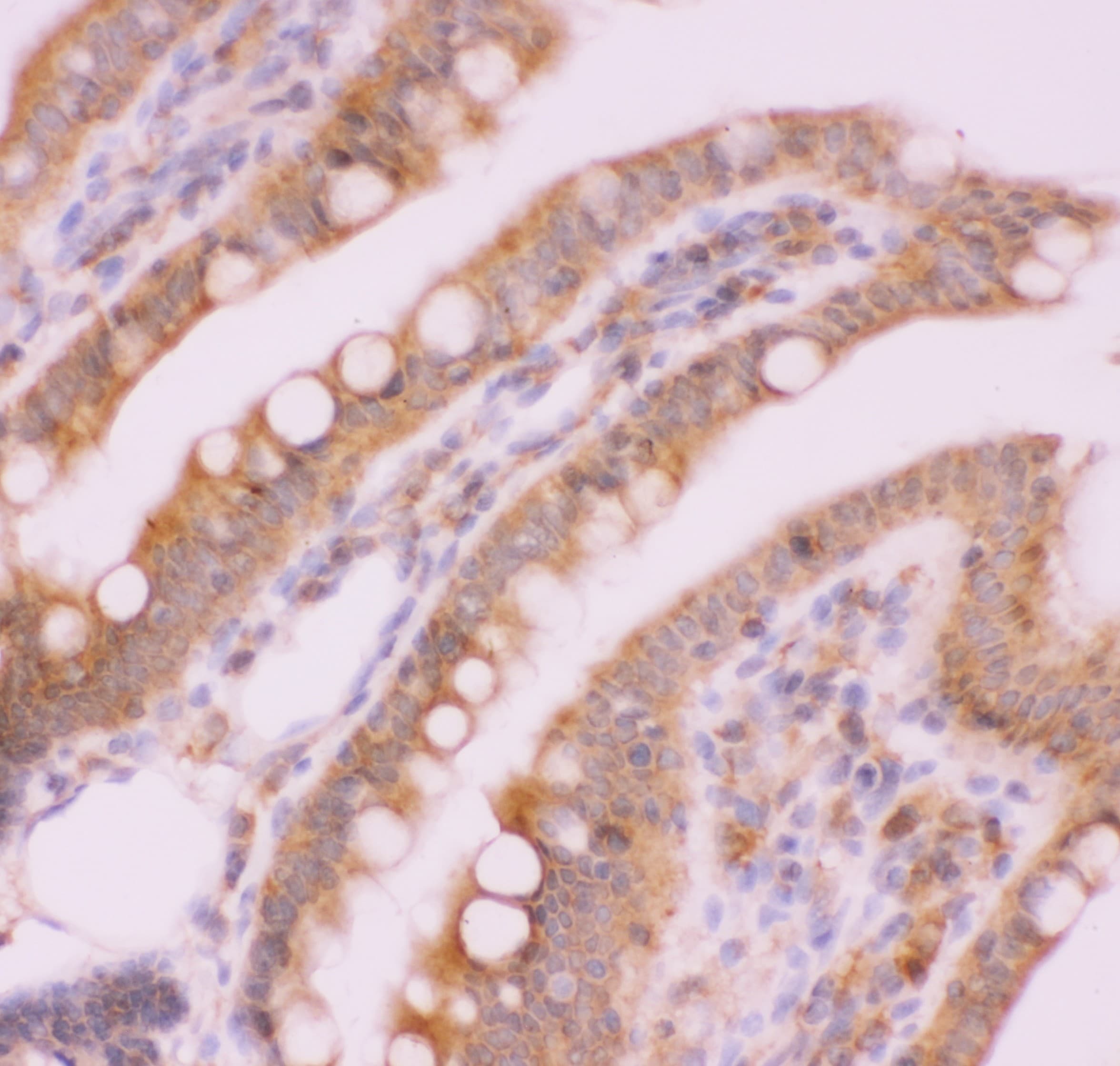 NFKB2 Antibody (aa1-340)