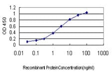 IHC-plus™ RAB8A / RAB8 Antibody (clone 3G1)