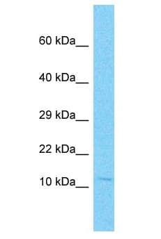 NANOS2 / NOS2 Antibody (aa83-132)