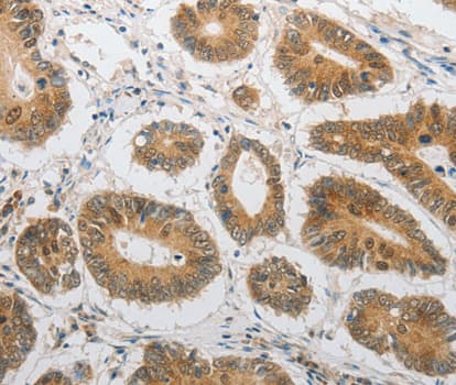 LEPR / Leptin Receptor Antibody