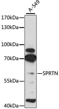 SPRTN / C1orf124 Antibody