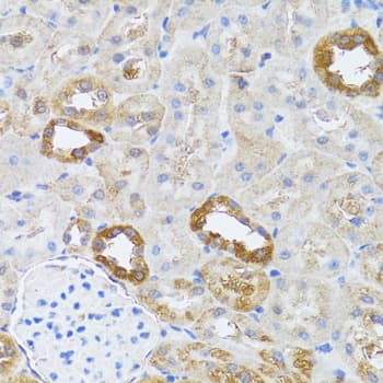 RNASEL / RNase L Antibody