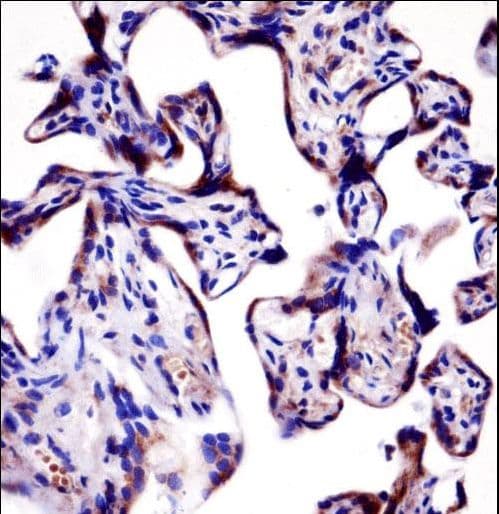 KCNA2 / Kv1.2 Antibody (aa451-479)