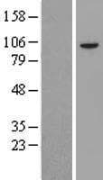 USP1 Protein (Over-Expression Lysate Myc-DDK (Flag))