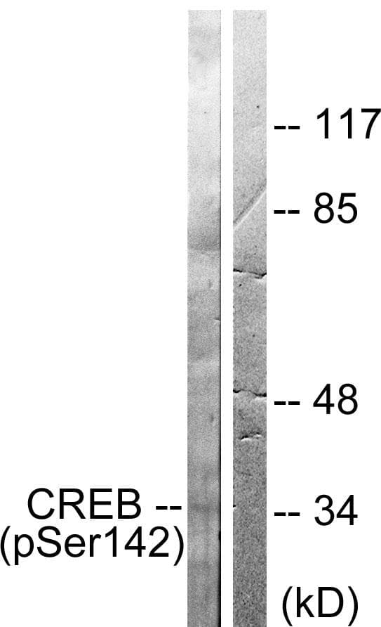 Polyclonal Rabbit anti-Human CREB1 / CREB Antibody (phospho-Ser142, IHC, IF, WB)