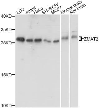 Polyclonal Rabbit anti-Human ZMAT2 Antibody (WB)