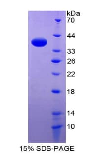 Human PLN / Phospholamban Protein (Recombinant His-GST)