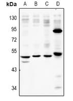 P2RX2 / P2X2 Antibody