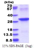 Human ABHD12B Protein (Recombinant His)