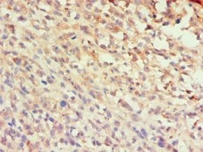 CCL25 / TECK Antibody (aa24-150)