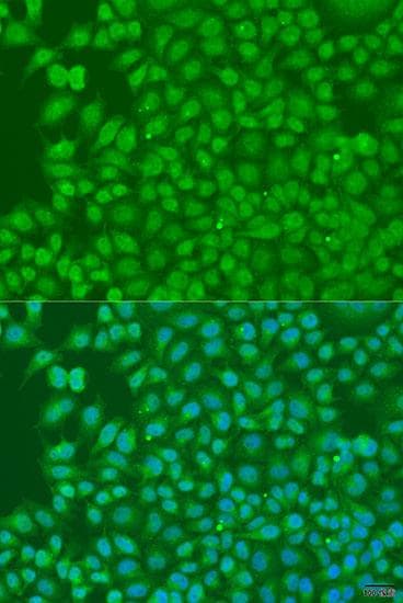BIRC3 / cIAP2 Antibody