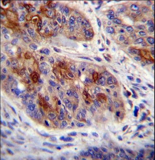 HAX-1 Antibody (aa161-190)