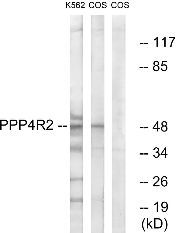 Polyclonal Rabbit anti-Human PPP4R2 Antibody (aa171-220, WB)