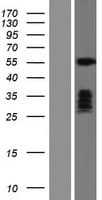 TBX1 Protein (Over-Expression Lysate Myc-DDK (Flag))