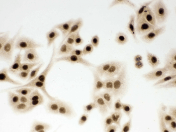 Polyclonal Rabbit anti-Human DDB1 Antibody (IHC, WB)