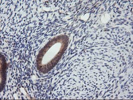 MAP2K3 / MEK3 / MKK3 Antibody (clone OTI5D3, Carrier-free)