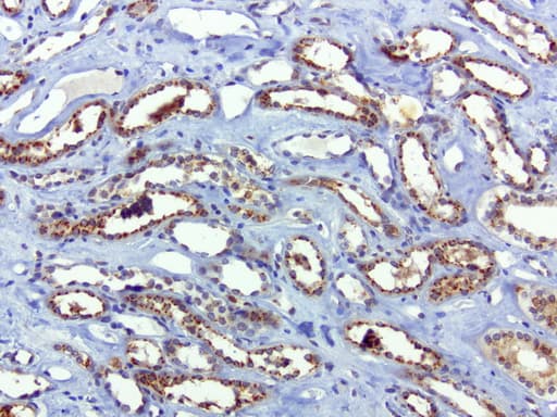 Monoclonal Mouse anti-Human SQSTM1 Antibody (clone UMAB12, Carrier-free, IHC, IF, WB)