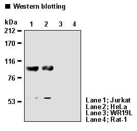 IHC-plus™ NCL / Nucleolin Antibody (clone 4E2)