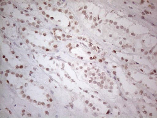 HDAC2 Antibody (aa415-488, clone OTI7E10)