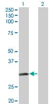 Monoclonal Mouse anti-Human NAT2 Antibody (clone 3B5, WB)