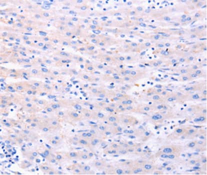 Polyclonal Rabbit anti-Human DUT / DUTPase Antibody (IHC, WB)