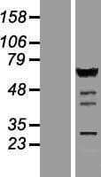 IRF5 Protein (Over-Expression Lysate Myc-DDK (Flag))