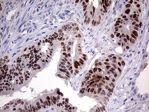 ELF3 / ESE1 Antibody (aa175-286, clone OTI6G6)