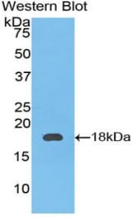 F9 / Factor IX Antibody (aa273-416, Biotin)