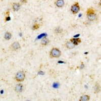IGFBP3 Antibody
