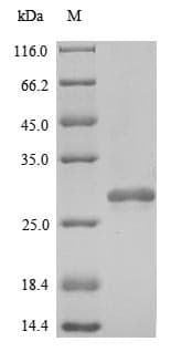 Human PRDX2 / Peroxiredoxin 2 Protein (Recombinant 10His, N-terminus)