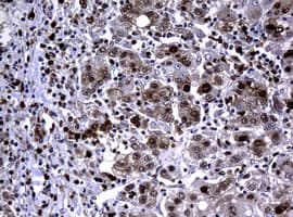 Monoclonal Mouse anti-Human PCNA Antibody (clone OTI1D11, IHC, WB)