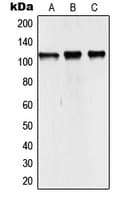 Polyclonal Rabbit anti-Human NCOA7 Antibody (Internal, IHC, WB)