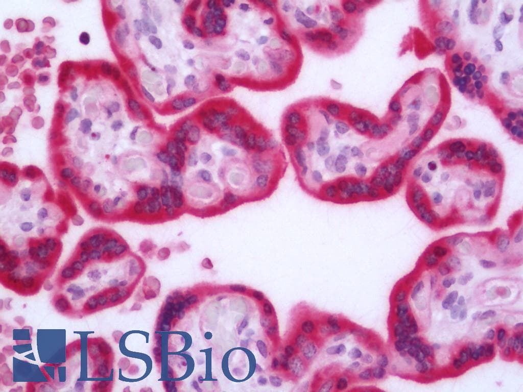 HDAC7 Antibody (HRP)