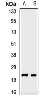 CD99 Antibody