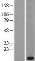 MT1G Protein (Over-Expression Lysate Myc-DDK (Flag))