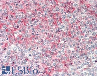 IHC-plus™ Polyclonal Rabbit anti-Human CD1D Antibody (IHC, IF, WB)