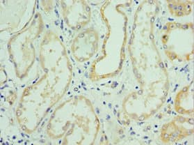 Polyclonal Rabbit anti-Human SLC39A6 / LIV-1 Antibody (aa170-320, IHC)