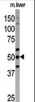 AUTL1 / ATG4C Antibody (aa33-62)