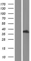 SUMF1 Protein (Over-Expression Lysate Myc-DDK (Flag))