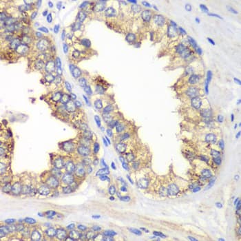IHC-plus™ KLK10 / Kallikrein 10 Antibody