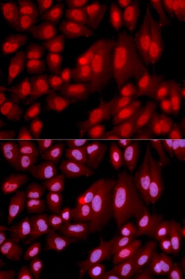 PPP2R2A Antibody