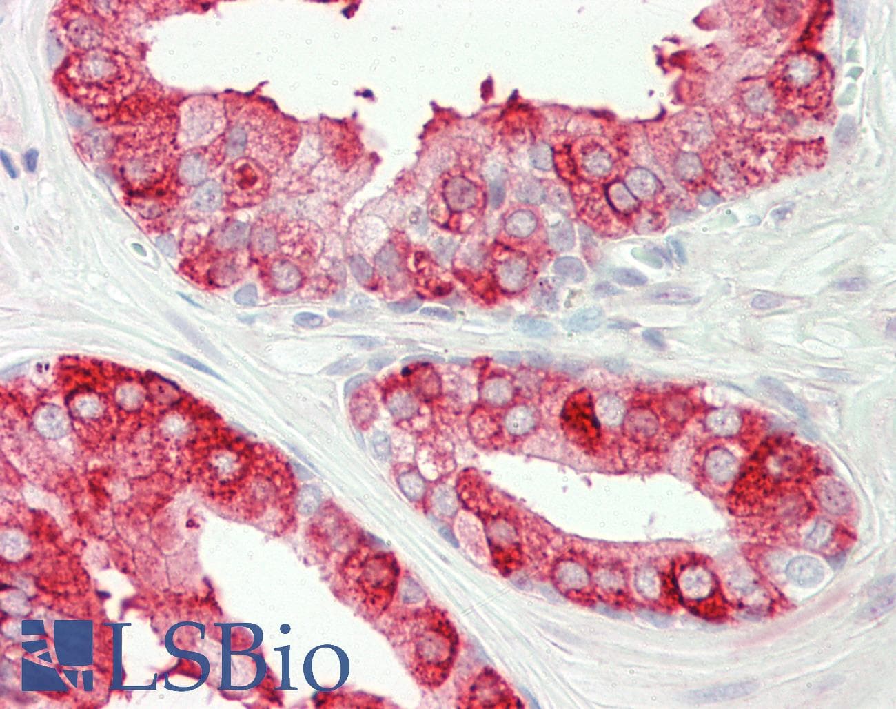 IHC-plus™ TAC3 / Tachykinin Antibody (aa54-83)
