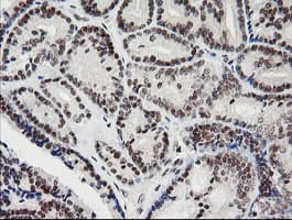 KIF25 Antibody (clone OTI2F2)