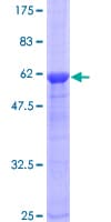 Human CENPK Protein (Recombinant GST)
