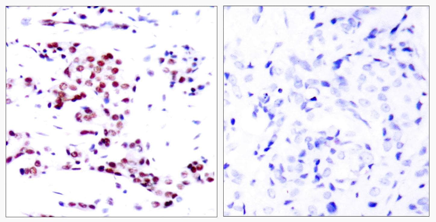 STAT5A Antibody (p780)