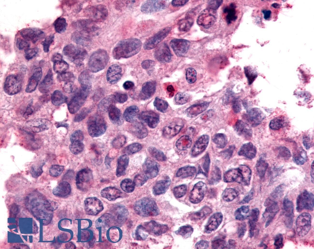 PathPlus™ Nor-1 / NR4A3 Antibody (C-Terminus)